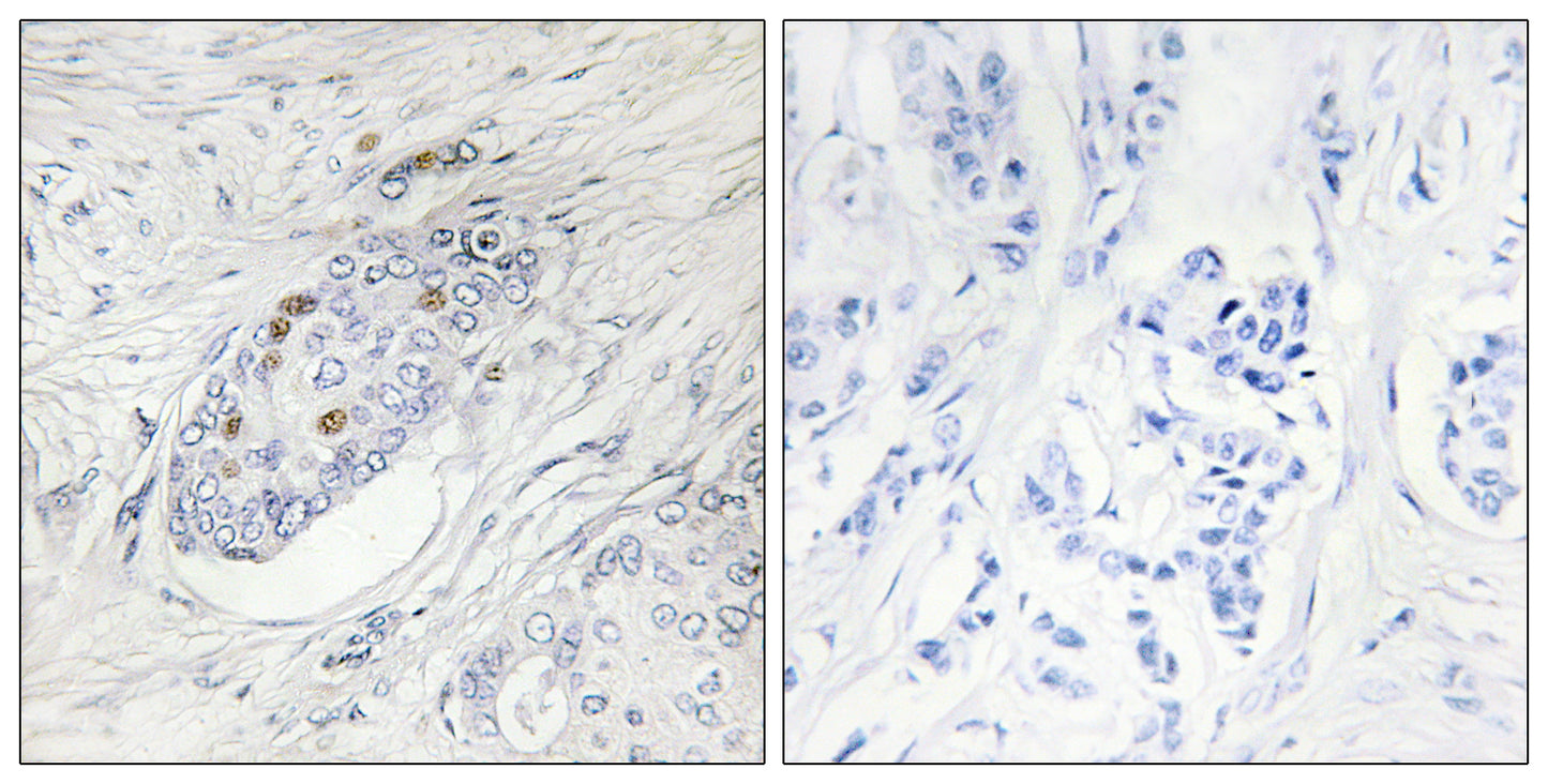 ZNF232 Rabbit Polyclonal Antibody