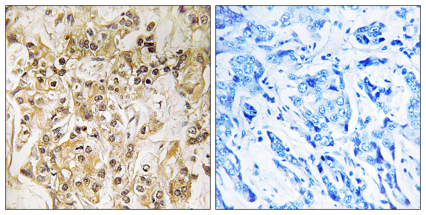 ZNF295 Rabbit Polyclonal Antibody