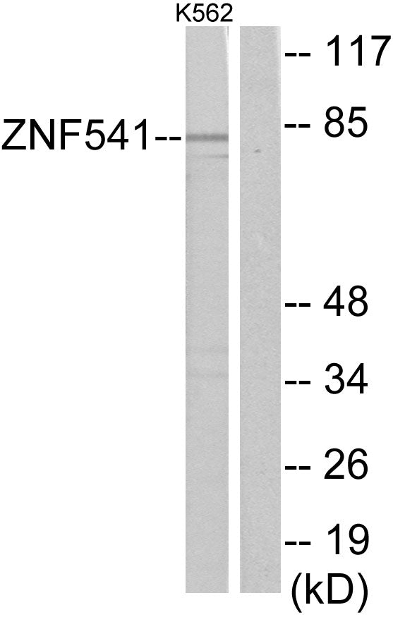 ZNF541 Rabbit Polyclonal Antibody
