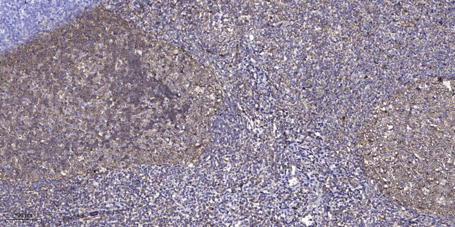 ZNF600 Rabbit Polyclonal Antibody