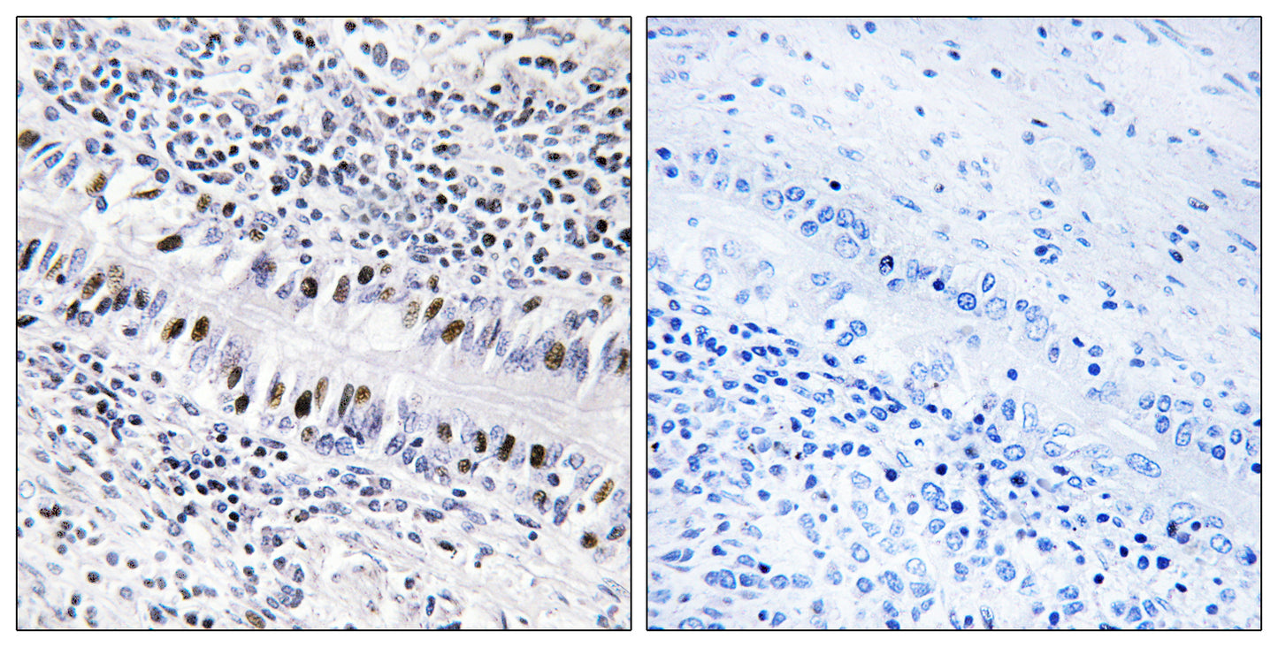 ZNF76 Rabbit Polyclonal Antibody