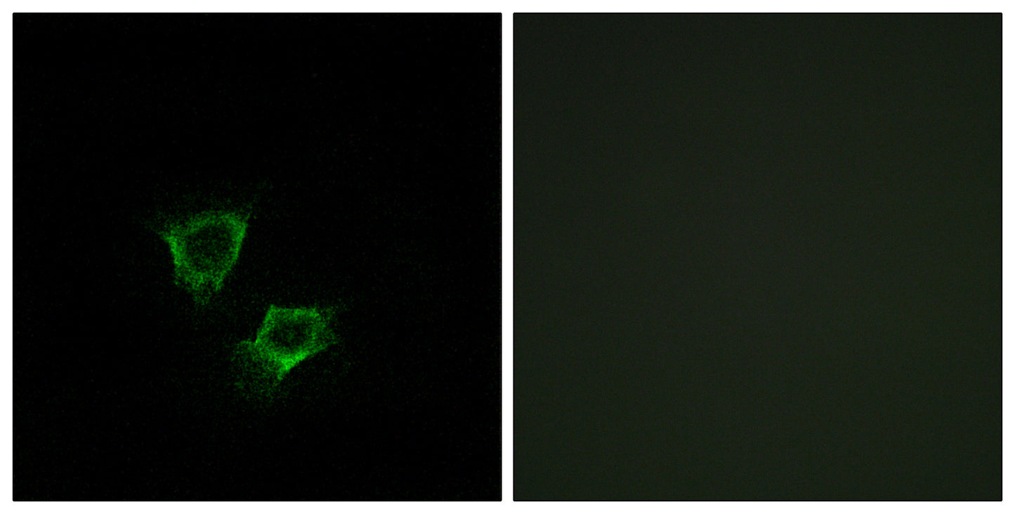 ZNRF2 Rabbit Polyclonal Antibody