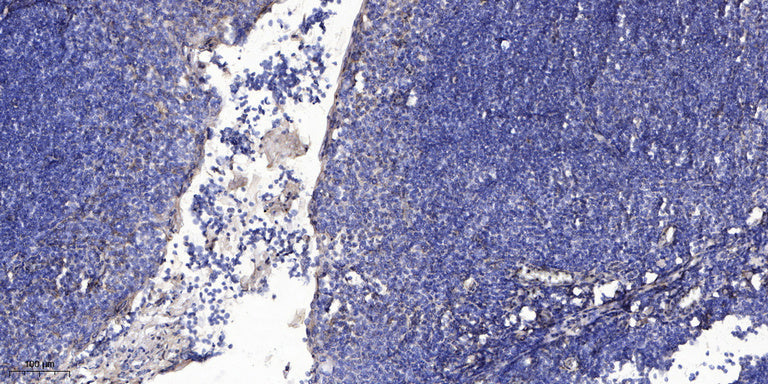ZnT-2 Rabbit Polyclonal Antibody
