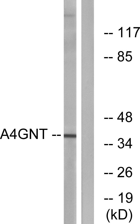 α4Gn-T Rabbit Polyclonal Antibody