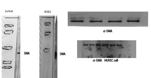 α-SMA Rabbit Polyclonal Antibody