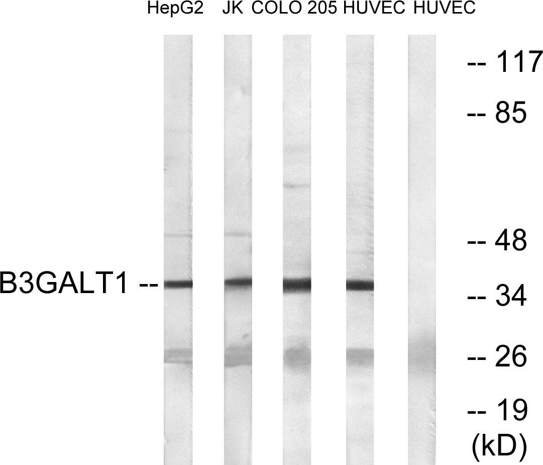 β-1,3-Gal-T1 Rabbit Polyclonal Antibody
