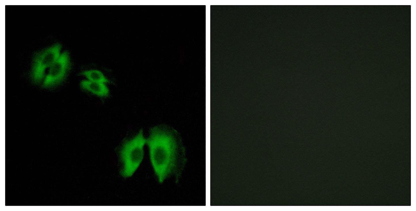 β-1,3-Gal-T2 Rabbit Polyclonal Antibody