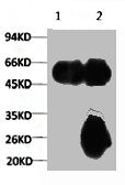 TUBA1A Monoclonal Antibody