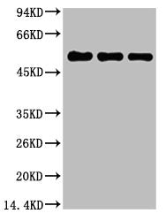 TUBB1 Monoclonal Antibody