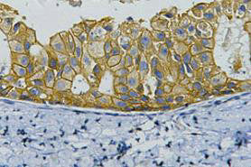 ERBB2 Monoclonal Antibody