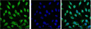 TP53 Monoclonal Antibody