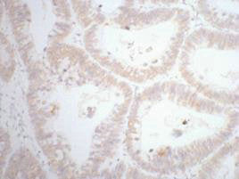 CDX2 Monoclonal Antibody