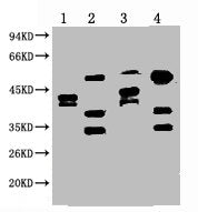 ERCC1 Monoclonal Antibody
