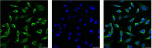 PRDX1 Monoclonal Antibody