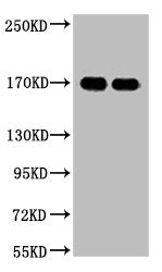 EGFR Monoclonal Antibody