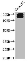 CDH1 Monoclonal Antibody