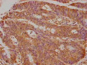 TFF3 Monoclonal Antibody