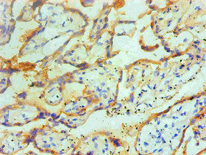 TGM2 Monoclonal Antibody