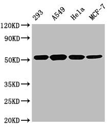 TUBB Monoclonal Antibody