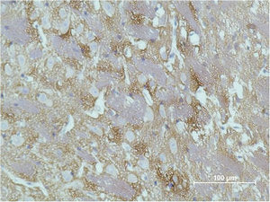 GAP43 Monoclonal Antibody