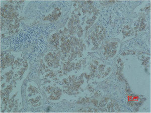 CTNNB1 Monoclonal Antibody