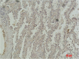 CREB1 Monoclonal Antibody