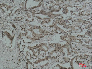 Acetyl Lysine Monoclonal Antibody