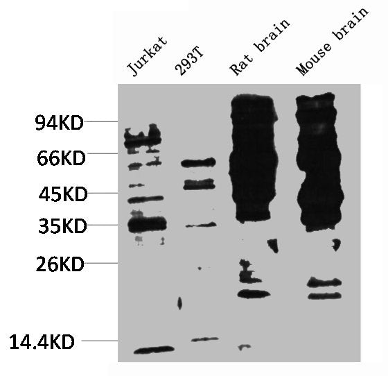 Phosphotyrosine Monoclonal Antibody
