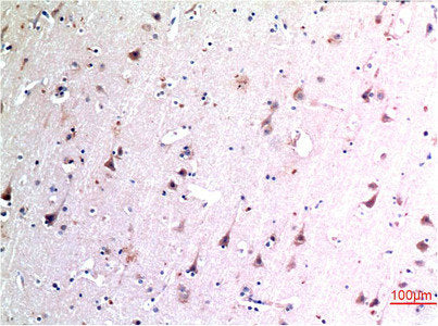 BECN1 Monoclonal Antibody