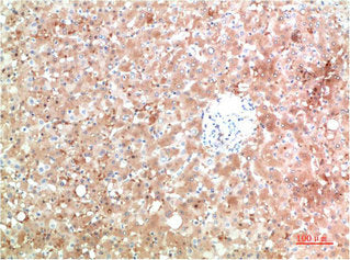 TTR Monoclonal Antibody