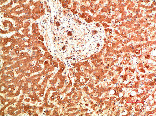 COL4A1 Monoclonal Antibody