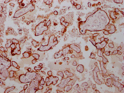 ANXA1 Monoclonal Antibody