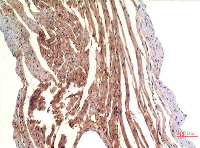 CDH5 Monoclonal Antibody
