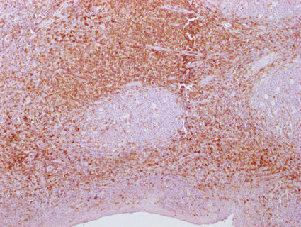 SPN Monoclonal Antibody