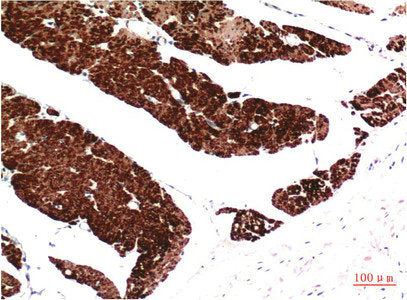 Muscle actin Monoclonal Antibody