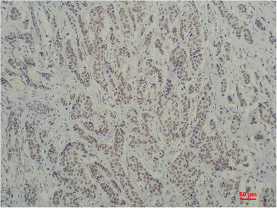 TBP Monoclonal Antibody