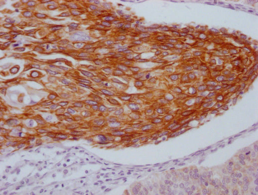 KRT5 Monoclonal Antibody
