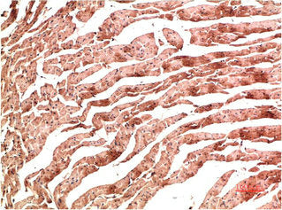 CDH5 Monoclonal Antibody