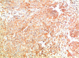 ATG7 Monoclonal Antibody