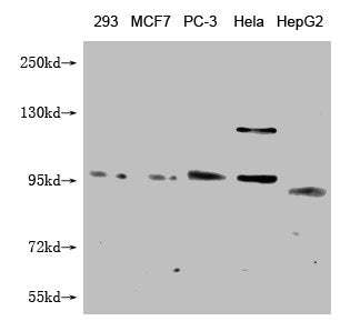 FILIP1L Monoclonal Antibody
