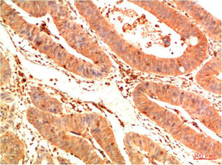 Acetyl-TP53(K382) Monoclonal Antibody