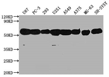 TUBA1A Monoclonal Antibody