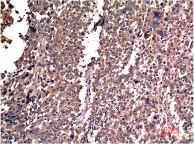 CCNB1 Monoclonal Antibody
