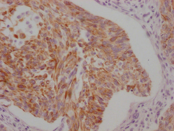 KRT5/KRT6A Monoclonal Antibody