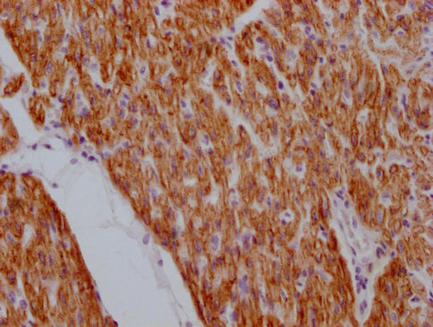 DES Monoclonal Antibody