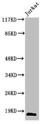 Cleaved-CASP2 (G170) Antibody