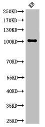 Cleaved-NOTCH1 (V1754) Antibody