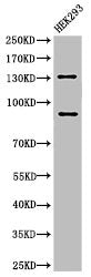 Cleaved-NOTCH2 (D1733) Antibody
