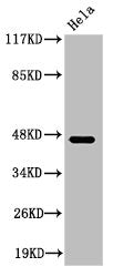 Cleaved-KLKB1 (R390) Antibody