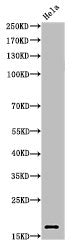 Acetyl-Histone H3 (K27) Antibody